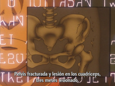 Soukou Kihei Votoms: Red Shoulder Document - Yabou no Roots